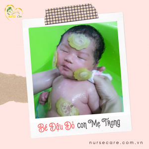 Các điều dưỡng viên của Nurse Care tiến hành dịch vụ tắm tại nhà cho bé Đậu Đỏ (con của mẹ Trang).